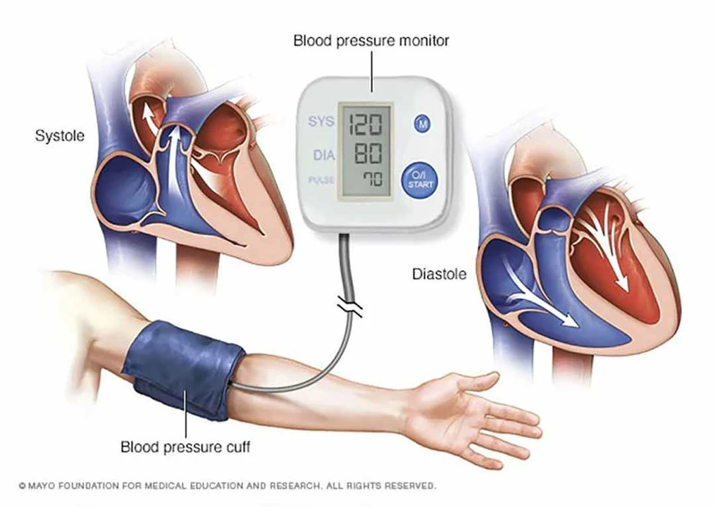 How Furosemide Can Help in the Treatment of Hypertensive Crisis